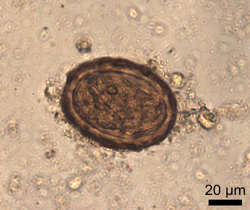 Roundworm egg from the analysis of sediment from the sewer drain